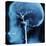 X-Ray of Human Head-Robert Llewellyn-Stretched Canvas