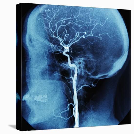 X-Ray of Human Head-Robert Llewellyn-Stretched Canvas