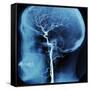 X-Ray of Human Head-Robert Llewellyn-Framed Stretched Canvas