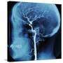 X-Ray of Human Head-Robert Llewellyn-Stretched Canvas