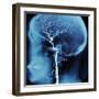 X-Ray of Human Head-Robert Llewellyn-Framed Premium Photographic Print