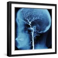 X-Ray of Human Head-Robert Llewellyn-Framed Premium Photographic Print