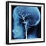 X-Ray of Human Head-Robert Llewellyn-Framed Premium Photographic Print