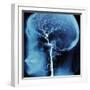 X-Ray of Human Head-Robert Llewellyn-Framed Premium Photographic Print