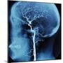 X-Ray of Human Head-Robert Llewellyn-Mounted Premium Photographic Print