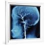 X-Ray of Human Head-Robert Llewellyn-Framed Photographic Print