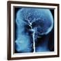 X-Ray of Human Head-Robert Llewellyn-Framed Photographic Print