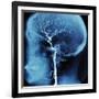 X-Ray of Human Head-Robert Llewellyn-Framed Photographic Print