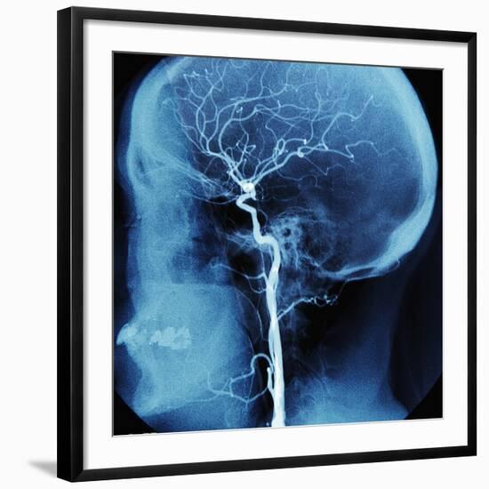 X-Ray of Human Head-Robert Llewellyn-Framed Photographic Print