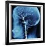 X-Ray of Human Head-Robert Llewellyn-Framed Photographic Print