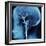 X-Ray of Human Head-Robert Llewellyn-Framed Photographic Print