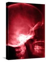 X-Ray of Human Skull-null-Stretched Canvas