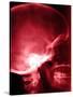 X-Ray of Human Skull-null-Stretched Canvas