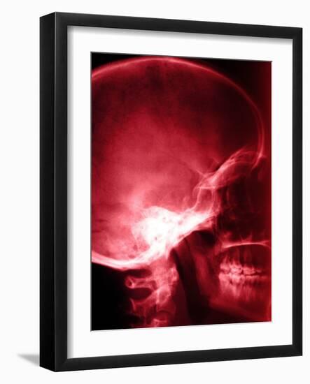 X-Ray of Human Skull-null-Framed Photographic Print