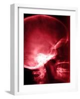 X-Ray of Human Skull-null-Framed Photographic Print