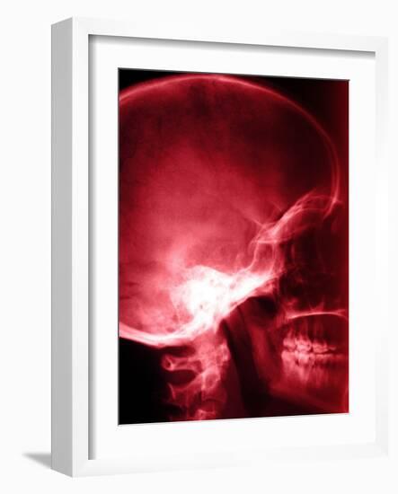 X-Ray of Human Skull-null-Framed Photographic Print