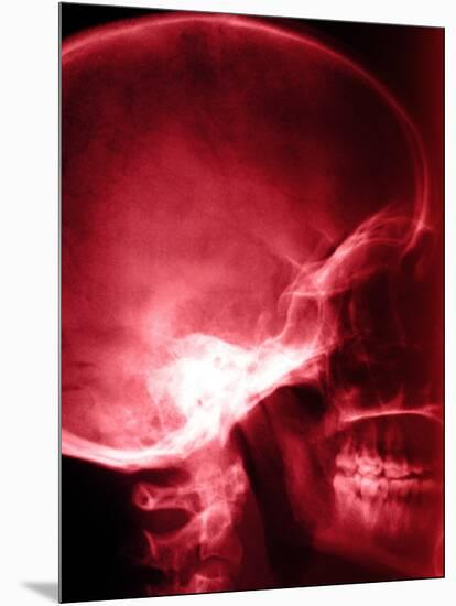 X-Ray of Human Skull-null-Mounted Photographic Print