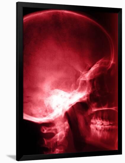 X-Ray of Human Skull-null-Framed Photographic Print