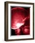 X-Ray of Human Skull-null-Framed Photographic Print