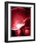 X-Ray of Human Skull-null-Framed Photographic Print