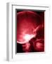 X-Ray of Human Skull-null-Framed Photographic Print