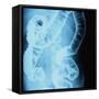 X-Ray of Intestines-Robert Llewellyn-Framed Stretched Canvas