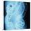 X-Ray of Intestines-Robert Llewellyn-Stretched Canvas