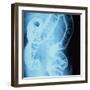 X-Ray of Intestines-Robert Llewellyn-Framed Premium Photographic Print