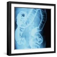 X-Ray of Intestines-Robert Llewellyn-Framed Premium Photographic Print