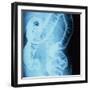 X-Ray of Intestines-Robert Llewellyn-Framed Premium Photographic Print