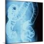 X-Ray of Intestines-Robert Llewellyn-Mounted Premium Photographic Print