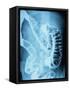 X-Ray of Intestines-Robert Llewellyn-Framed Stretched Canvas