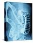 X-Ray of Intestines-Robert Llewellyn-Stretched Canvas