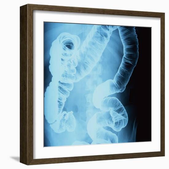 X-Ray of Intestines-Robert Llewellyn-Framed Photographic Print