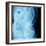 X-Ray of Intestines-Robert Llewellyn-Framed Photographic Print