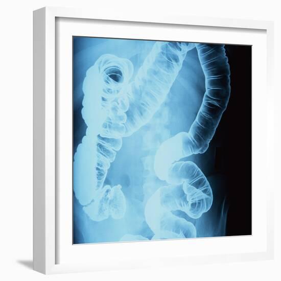 X-Ray of Intestines-Robert Llewellyn-Framed Photographic Print