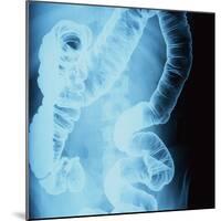 X-Ray of Intestines-Robert Llewellyn-Mounted Photographic Print