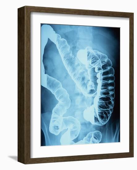 X-Ray of Intestines-Robert Llewellyn-Framed Photographic Print