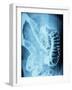 X-Ray of Intestines-Robert Llewellyn-Framed Photographic Print