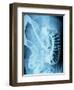 X-Ray of Intestines-Robert Llewellyn-Framed Photographic Print