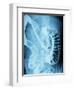 X-Ray of Intestines-Robert Llewellyn-Framed Photographic Print