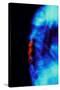 X-ray of Osteoporosis of the Thoracic Spine-Science Photo Library-Stretched Canvas