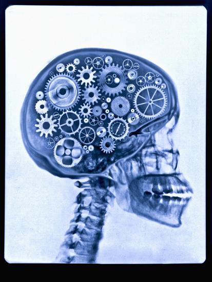 X-ray of skull with gears-Thom Lang-Stretched Canvas