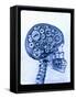 X-ray of skull with gears-Thom Lang-Framed Stretched Canvas