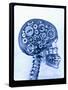 X-ray of skull with gears-Thom Lang-Framed Stretched Canvas