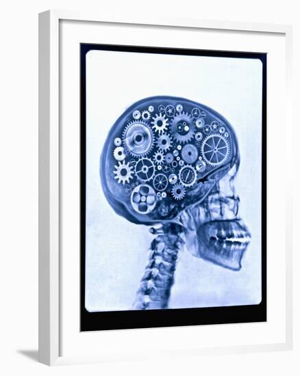 X-ray of skull with gears-Thom Lang-Framed Premium Photographic Print