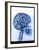 X-ray of skull with gears-Thom Lang-Framed Premium Photographic Print