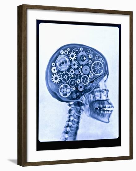 X-ray of skull with gears-Thom Lang-Framed Premium Photographic Print