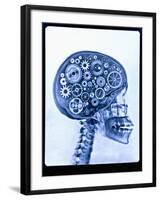 X-ray of skull with gears-Thom Lang-Framed Premium Photographic Print