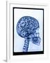 X-ray of skull with gears-Thom Lang-Framed Photographic Print